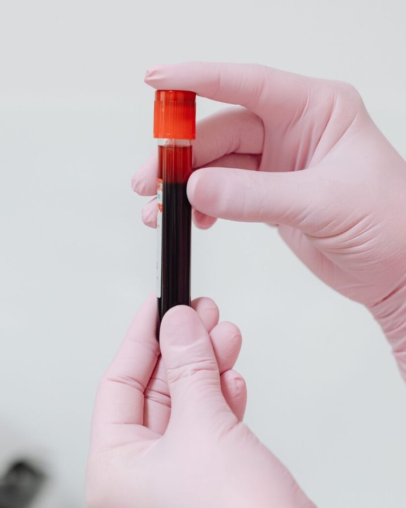 GFC and Biotin PRP