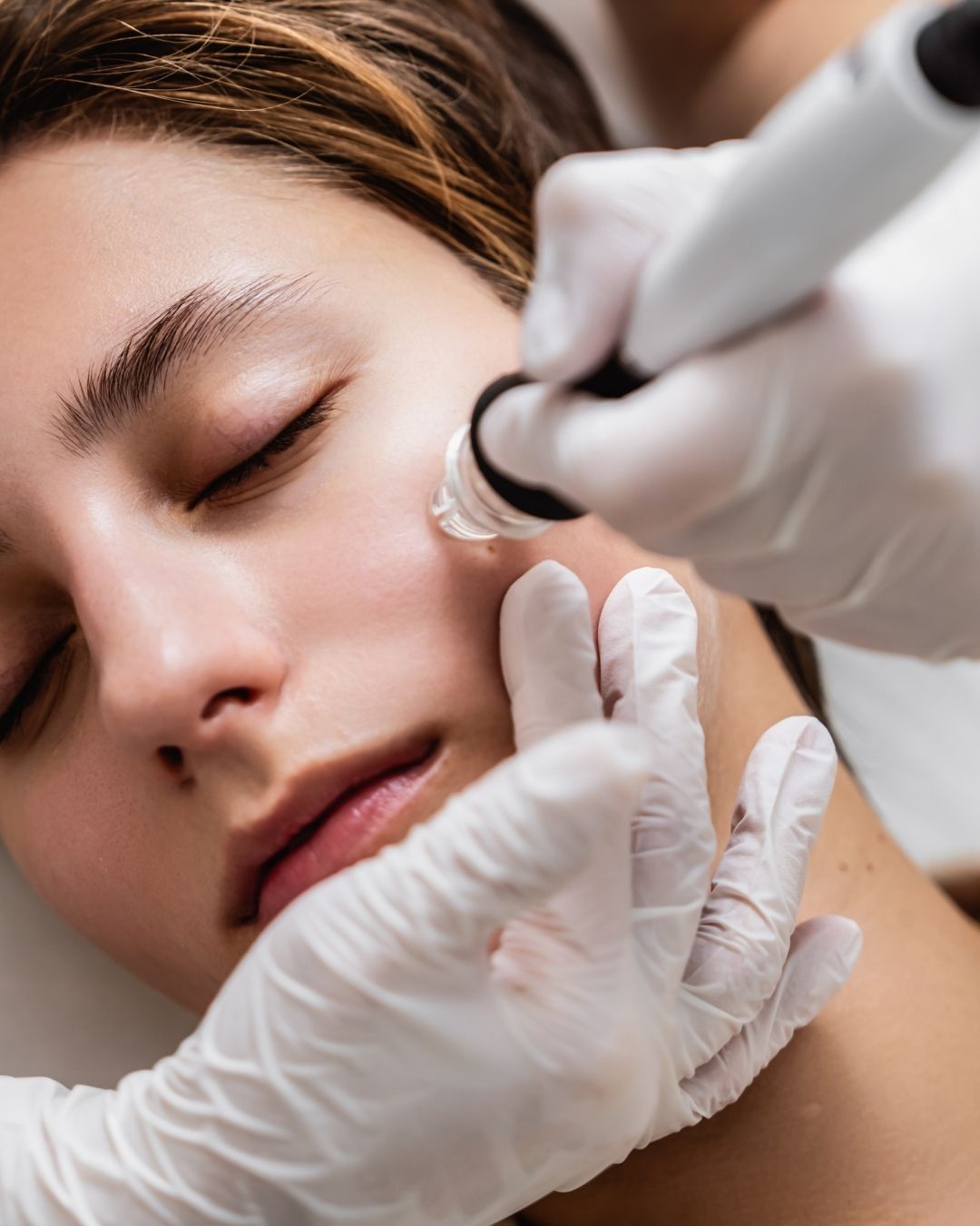 HydraFacial