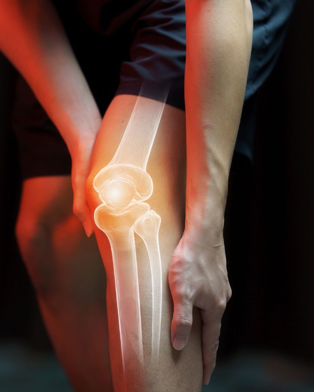 Joint Rehabilitation