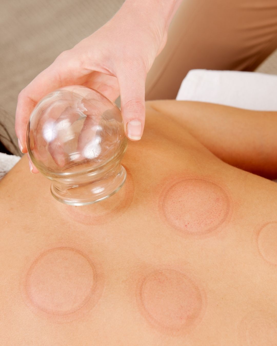 Lymphatic Cupping